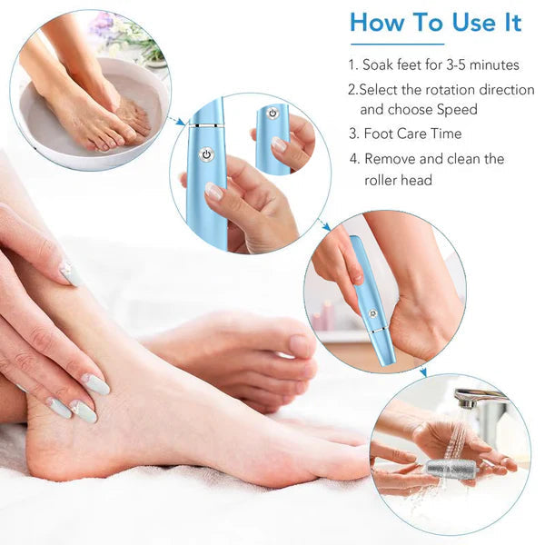 SmoothStep - Electric Callus Remover