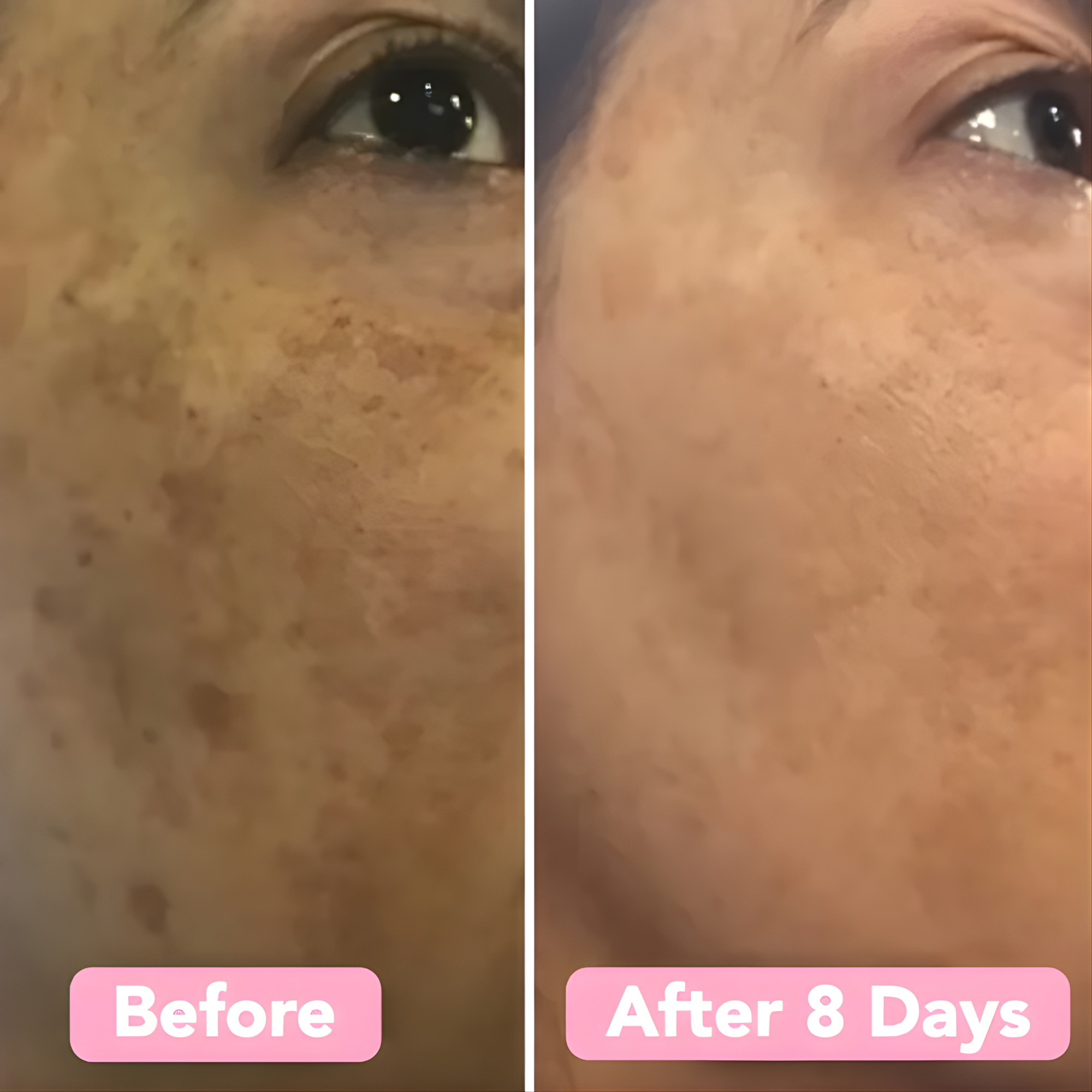 RenewGlow - Exfoliating Face Pads