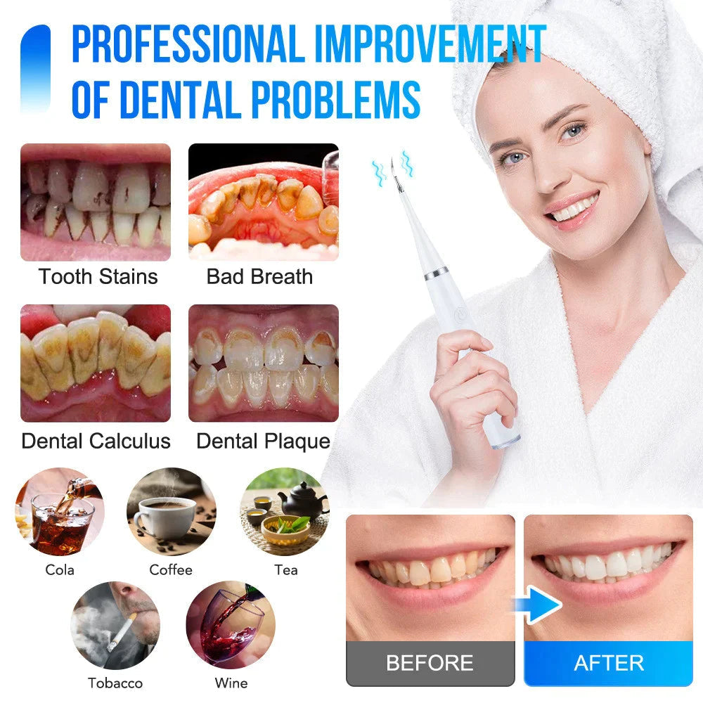 SmilePulse — Electric Sonic Toothbrush with Multiple Modes & Replacement Heads