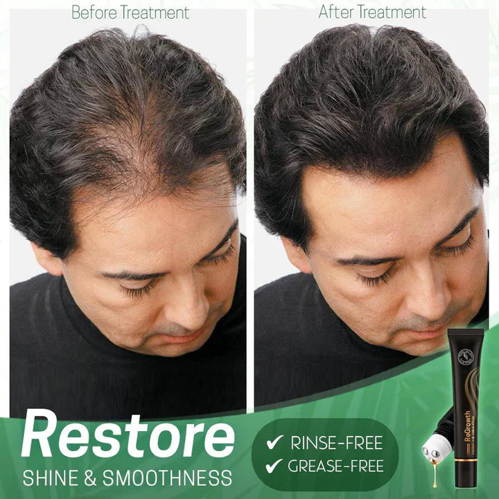 HairGlow - Scalp Serum Roller Applicator
