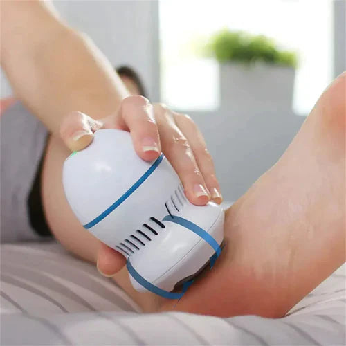 SmoothStep - Electric Foot Callus Remover