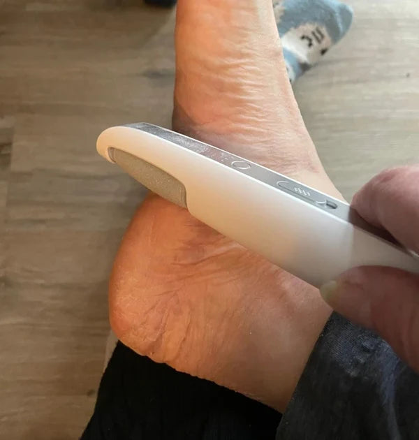 SmoothStep - Electric Callus Remover