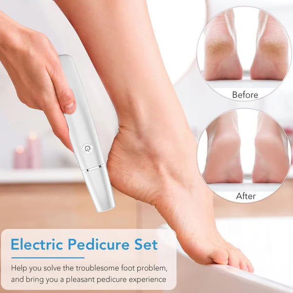 SmoothStep - Electric Callus Remover