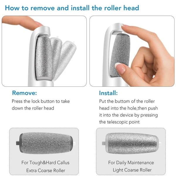SmoothStep - Electric Callus Remover