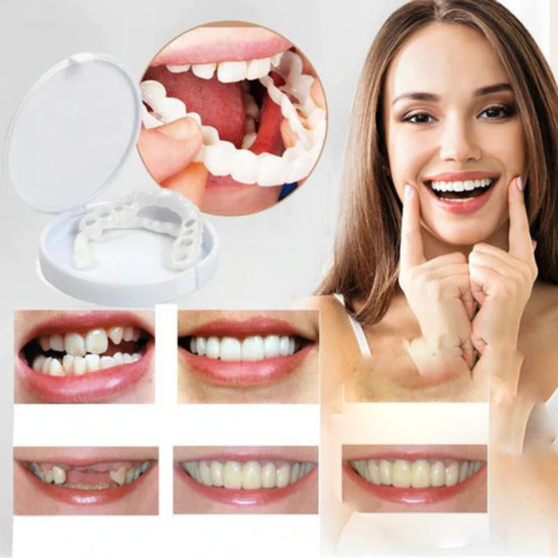 RadianceWrap - Cosmetic Smile Cover