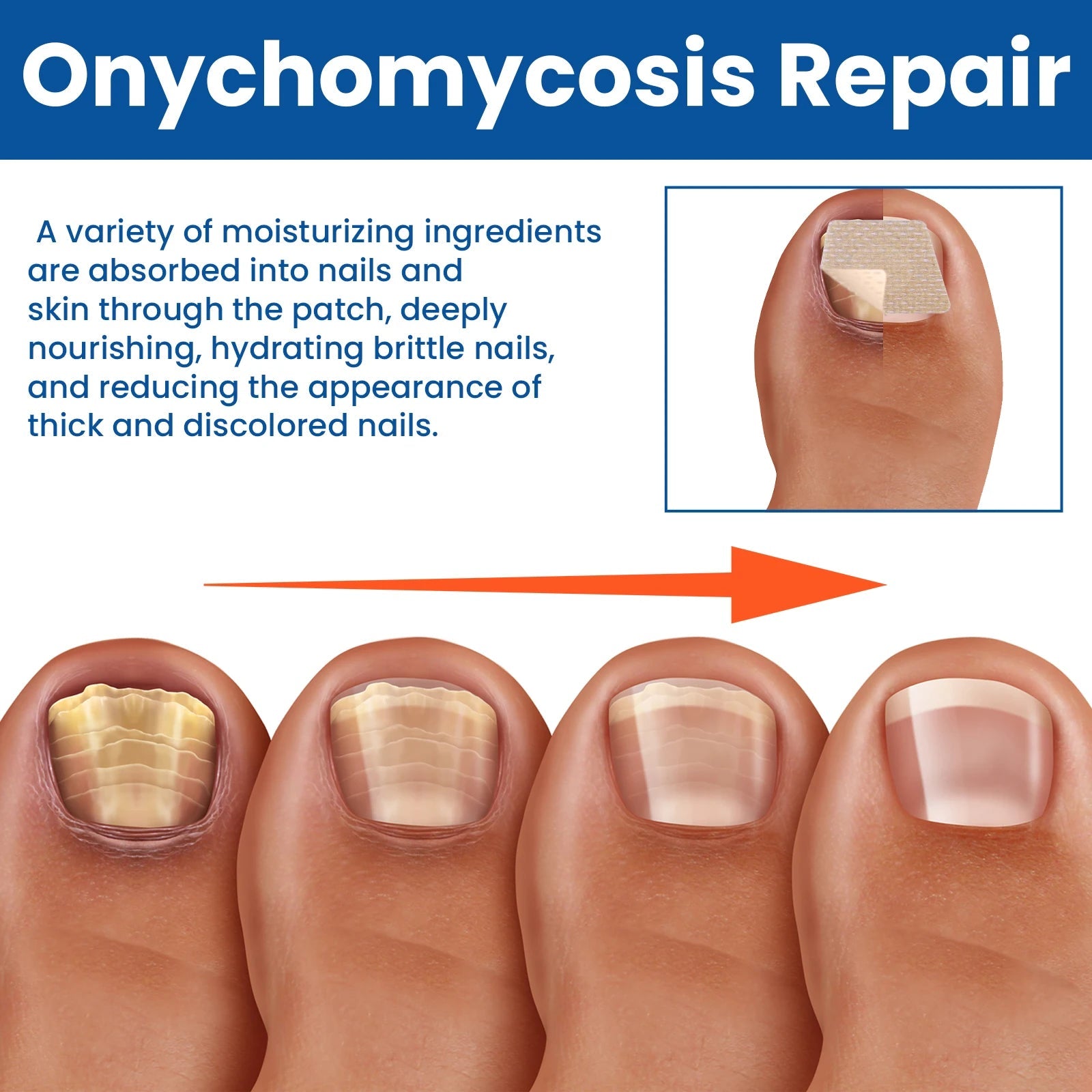 Nail Care Repair Patches for Damaged and Discolored Nails