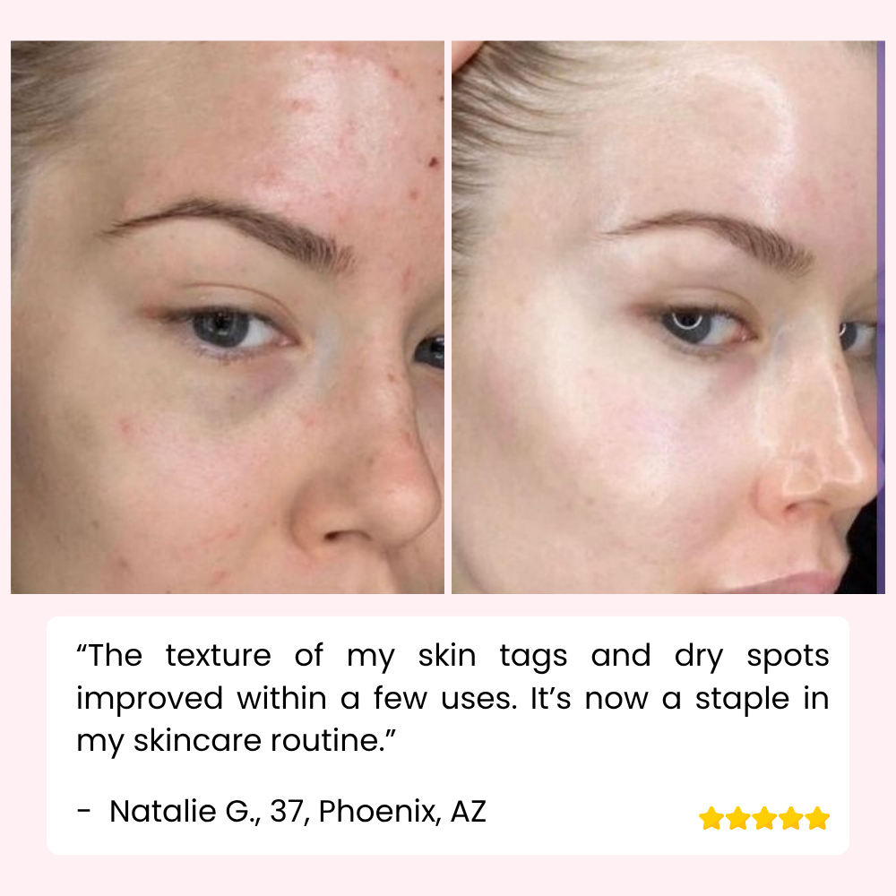 West Month — Mild eksfolierende gel