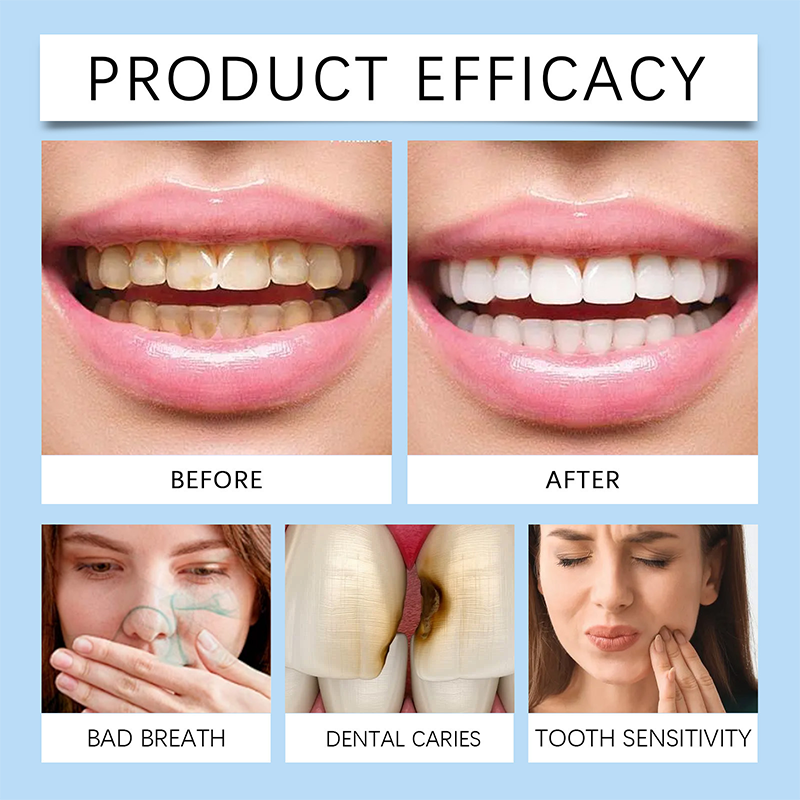 ShineGuard - Daily Dental Care Foam