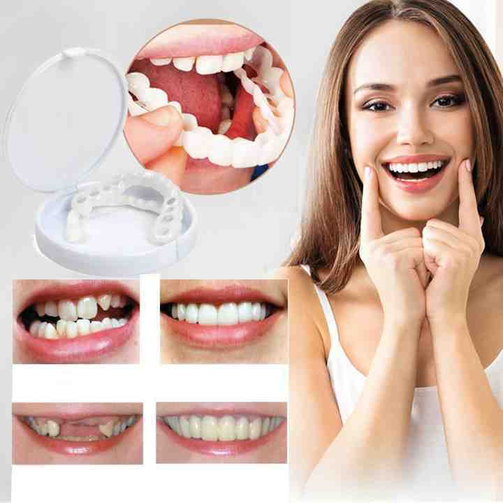 SmileSnap – nacvakávací kosmetický kryt na zuby