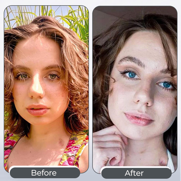 EyeKolor kapky pro zvýraznění duhovky – pro jasnější vzhled očí