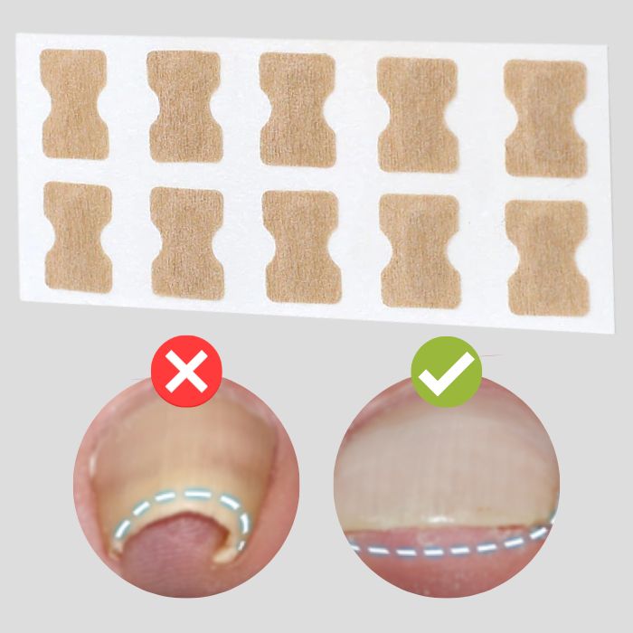 FinePatches - Protective Nail Care Patches