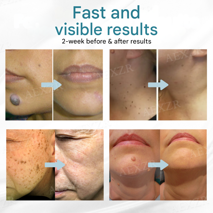SkinRefine – precizní přístroj na péči o pleť