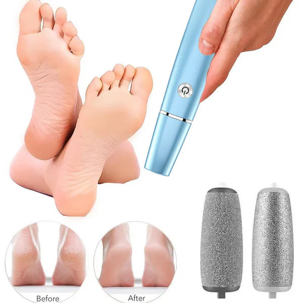 SmoothStep - Electric Callus Remover