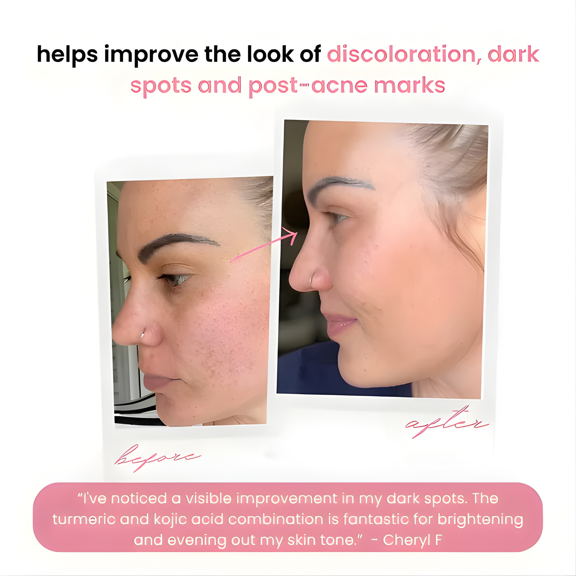 RenewGlow - Exfoliating Face Pads