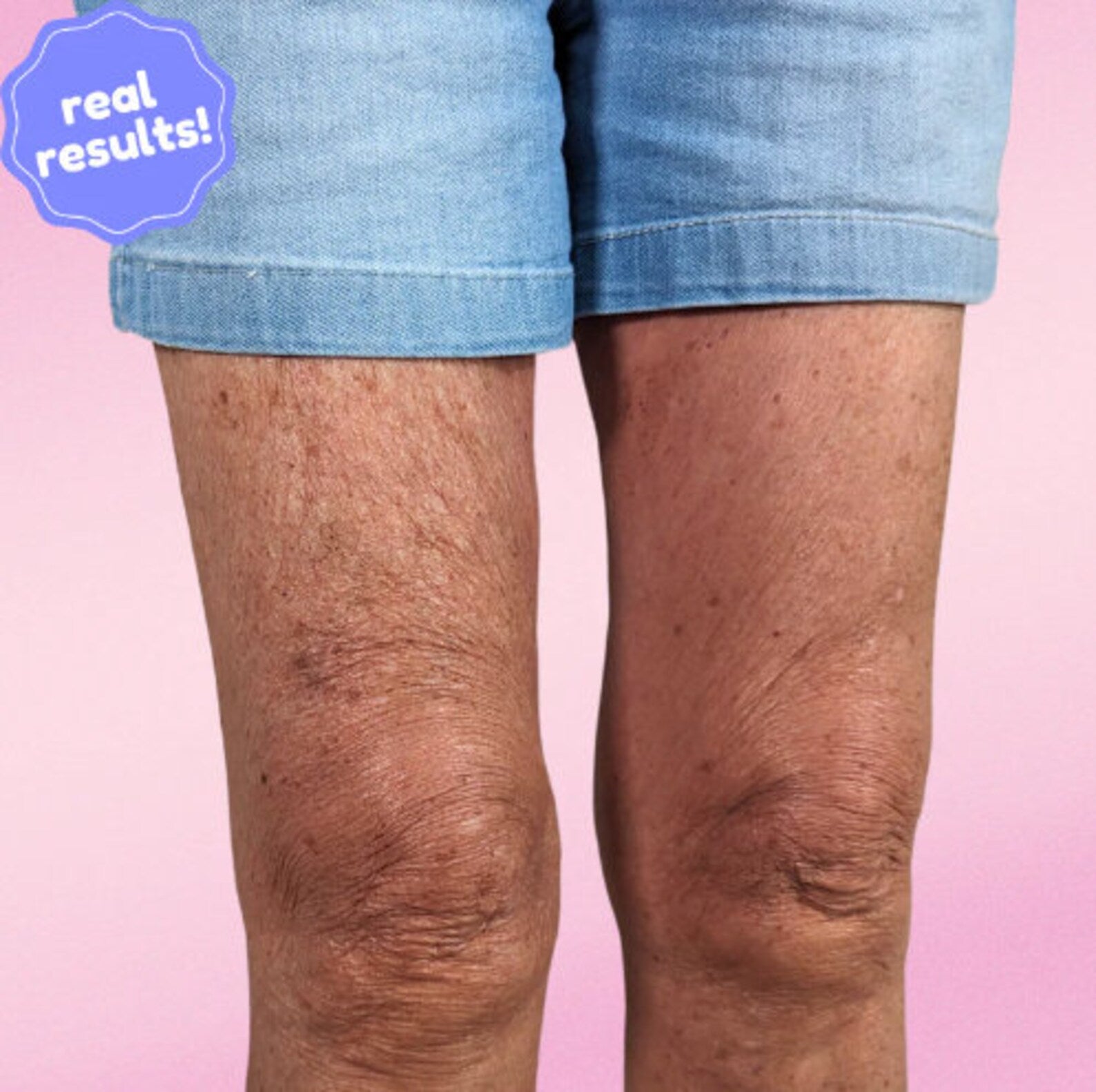 VeloraLift — Body Contouring Lift Patches for Discreet Shaping and Clothing Support