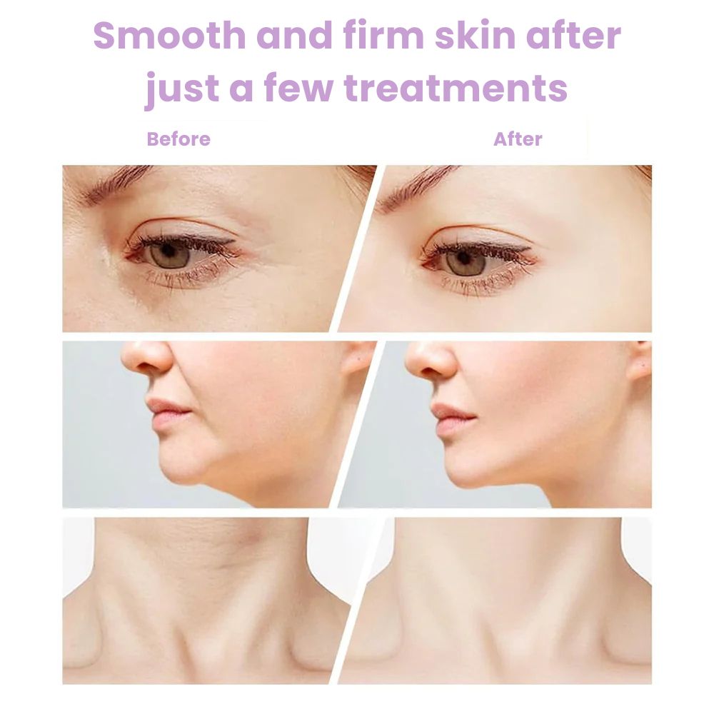 MaxReju - Facial & Neck Massage Device