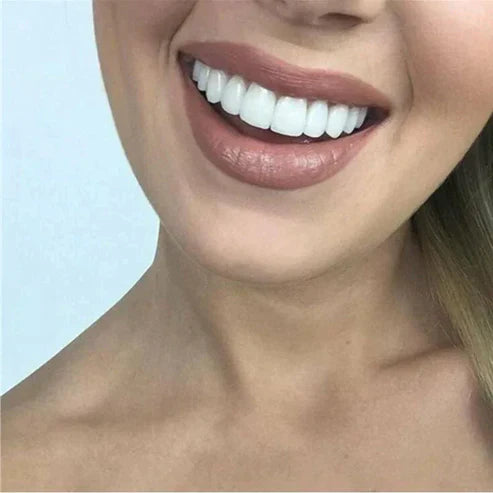 RadianceWrap - Cosmetic Smile Cover