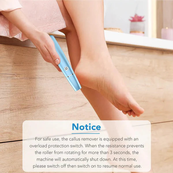 SmoothStep - Electric Callus Remover