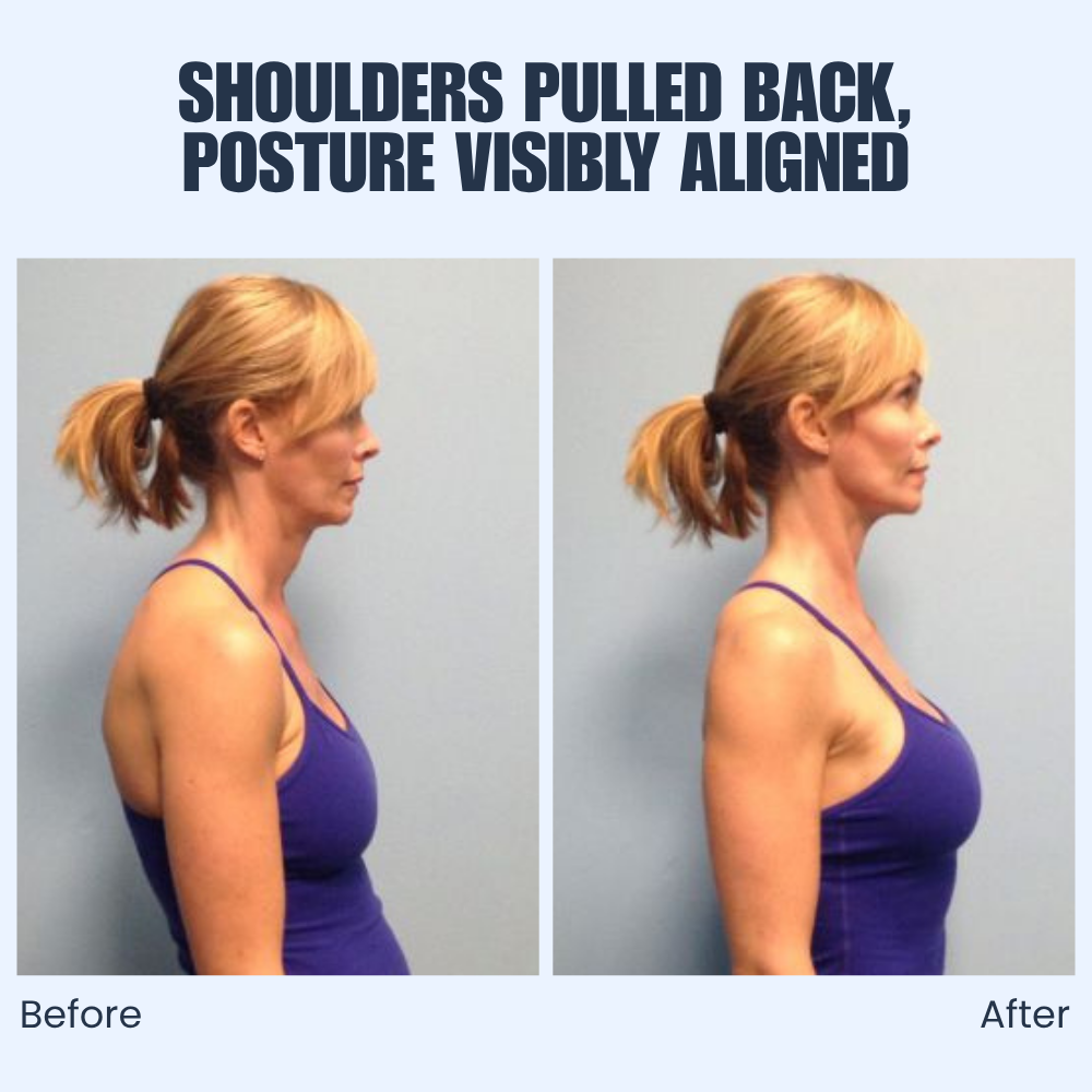 SpineLift - Adjustable Back Posture Support