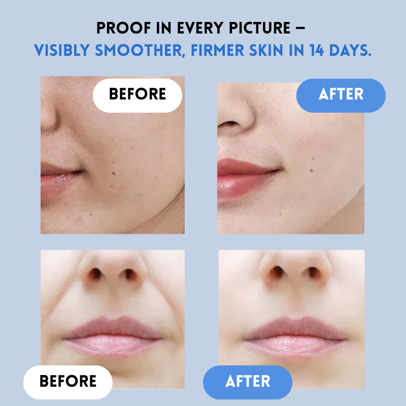 YouthLift -  Renew Facial Strips