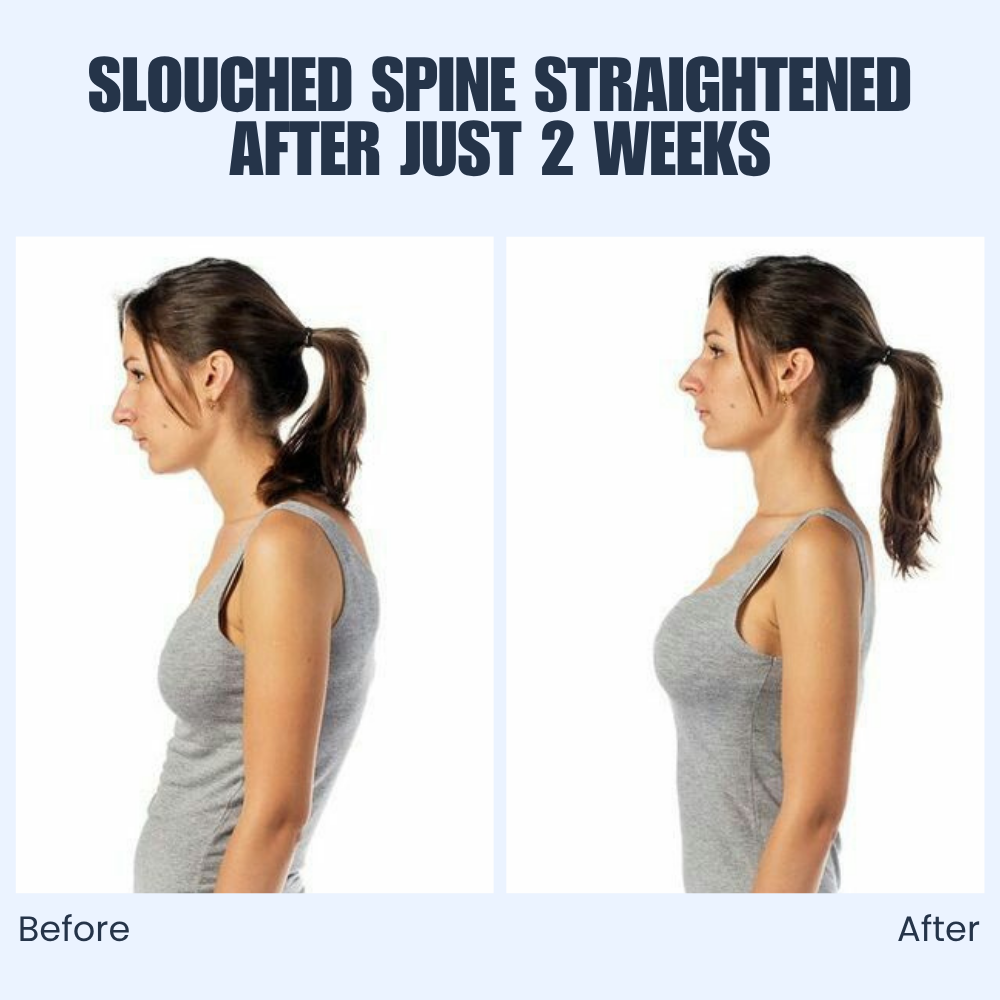 SpineLift - Adjustable Back Posture Support