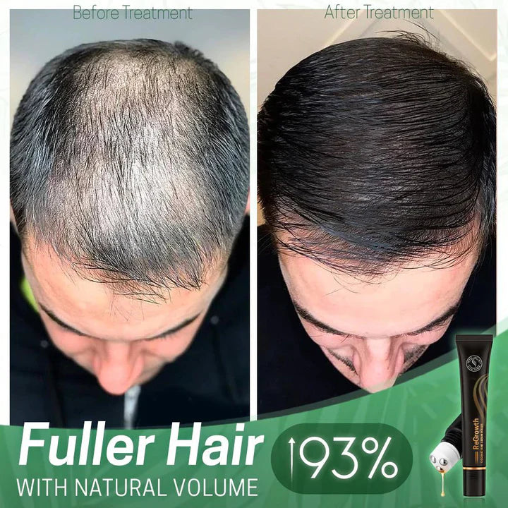 HairGlow - Scalp Serum Roller Applicator