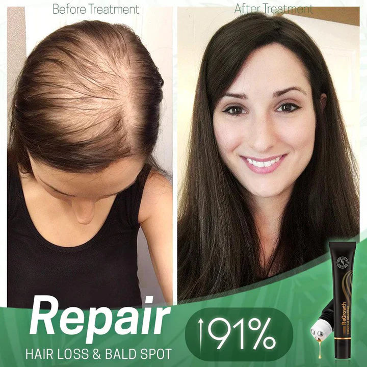 HairGlow - Scalp Serum Roller Applicator