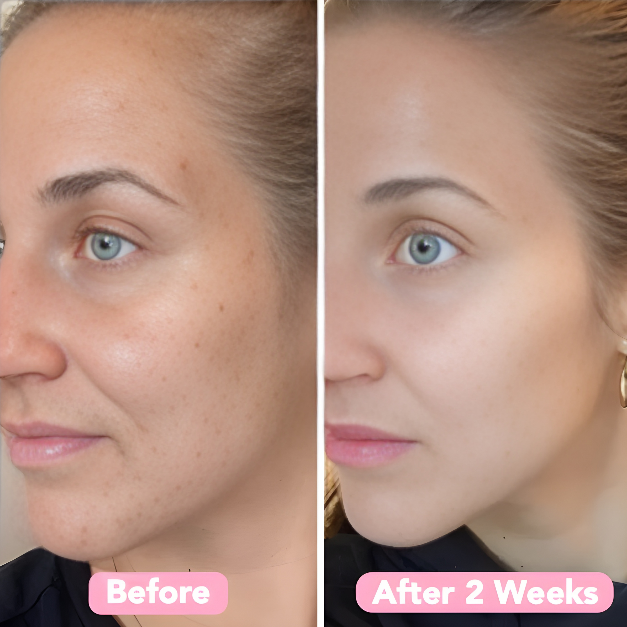 RenewGlow - Exfoliating Face Pads