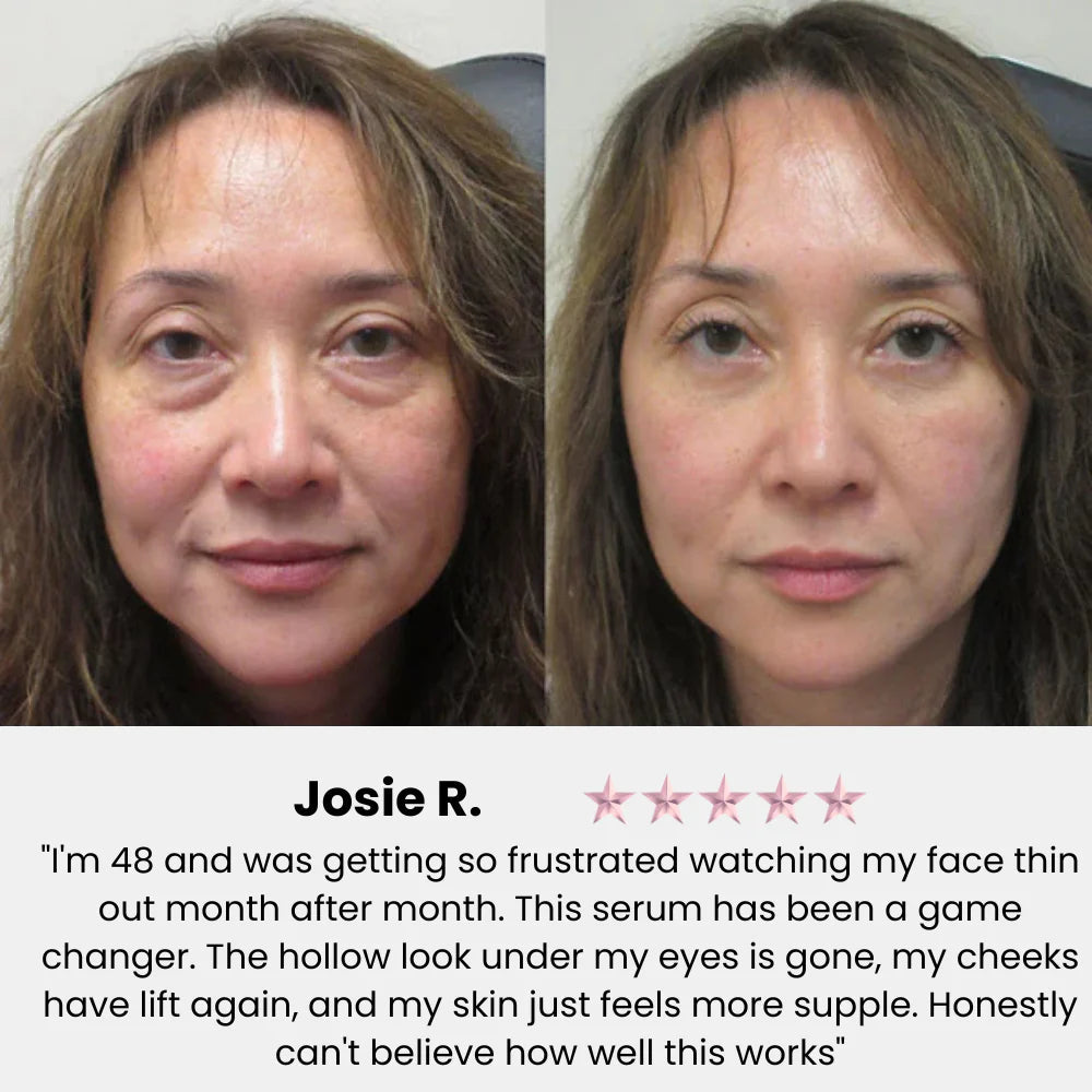 VivaDerm - Cream-in-Serum Skincare Formula