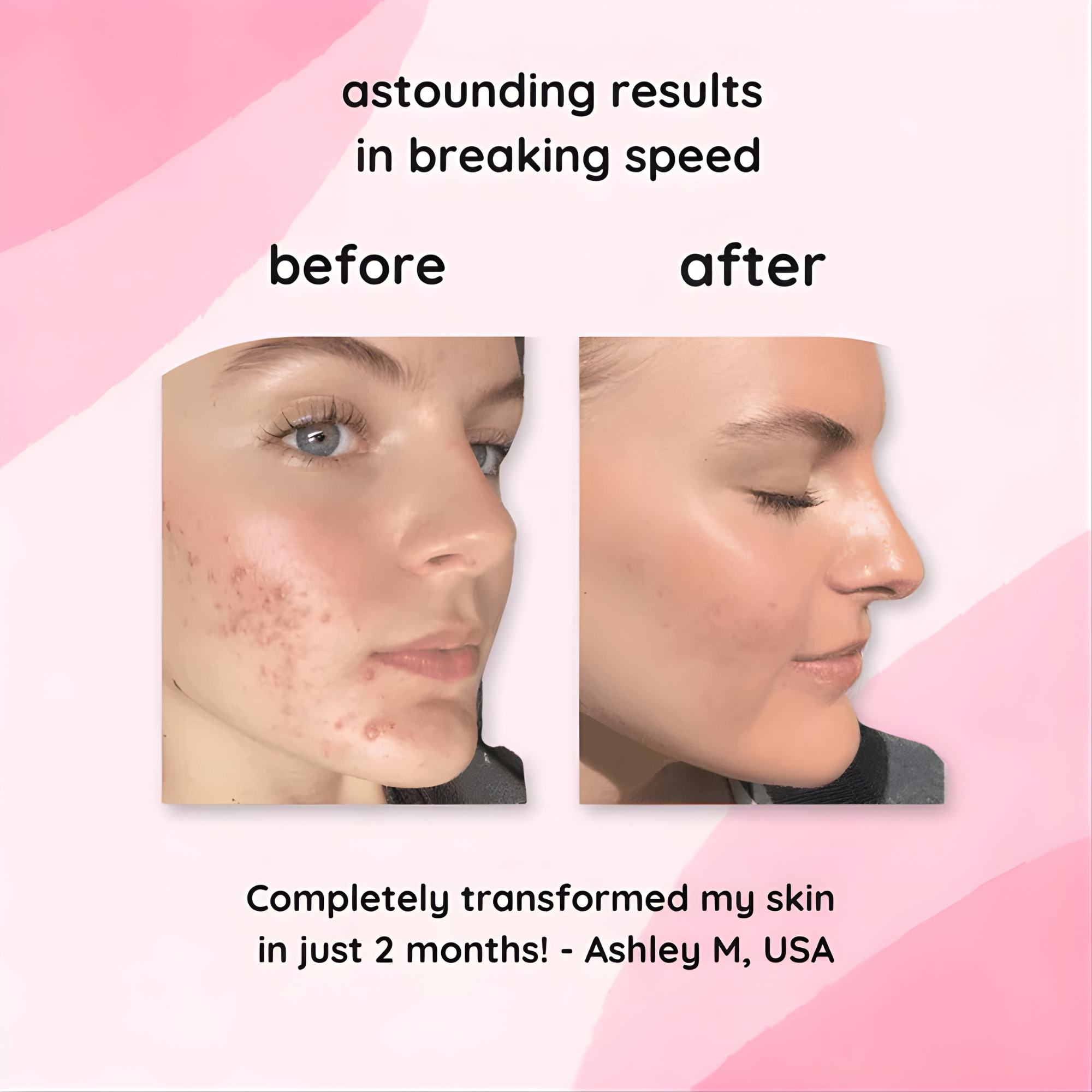 RenewGlow - Exfoliating Face Pads
