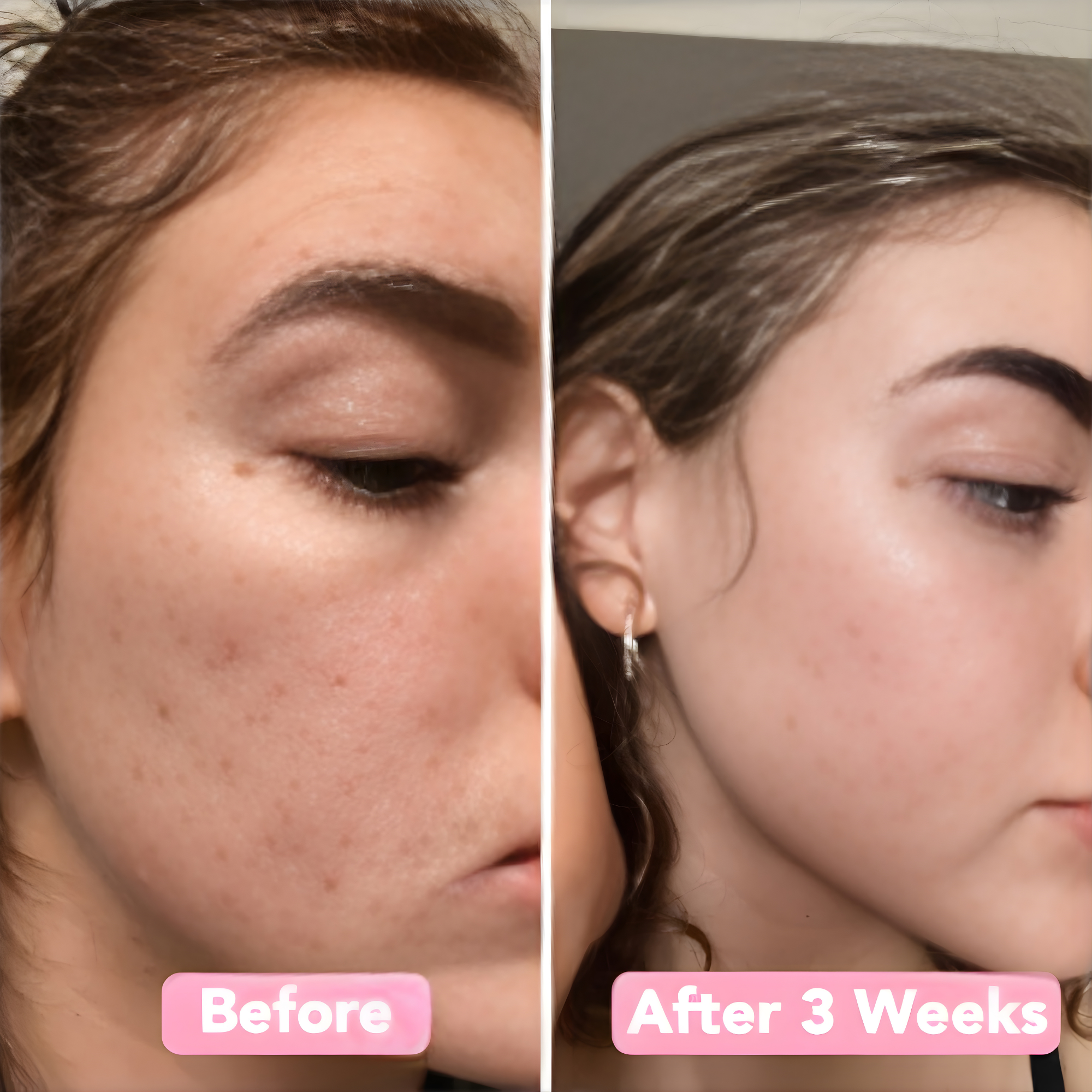 RenewGlow - Exfoliating Face Pads