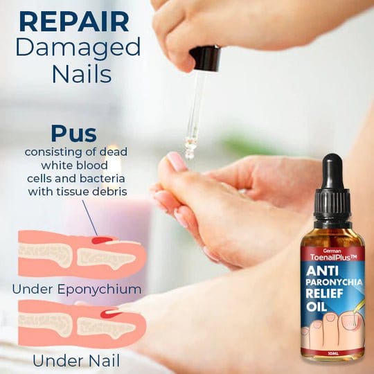 ToenailPlus - Anti-Paronychia Ingrown Nail & Cuticle Care Oil