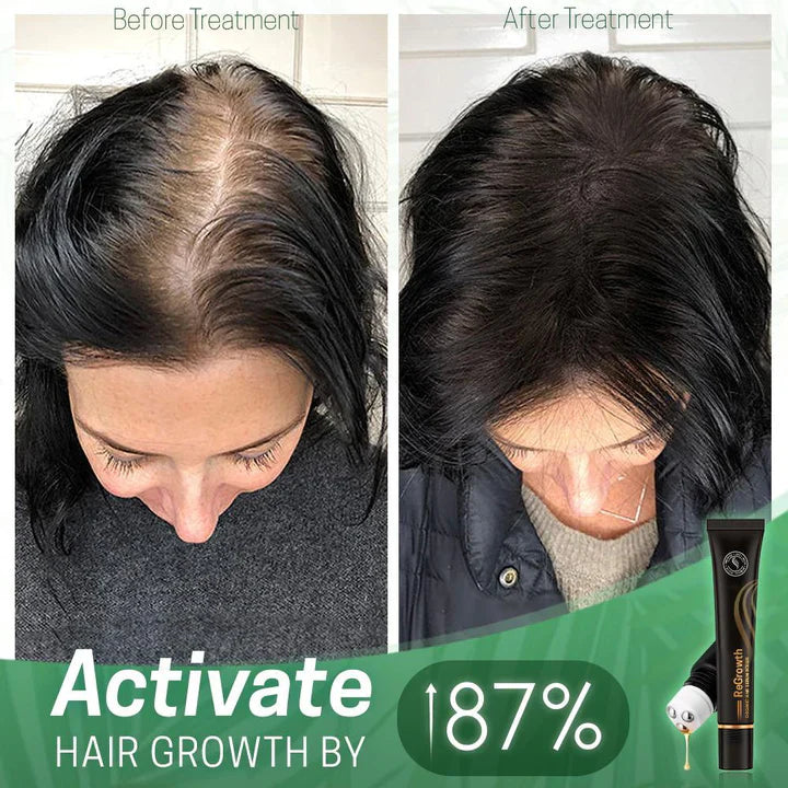 HairGlow - Scalp Serum Roller Applicator