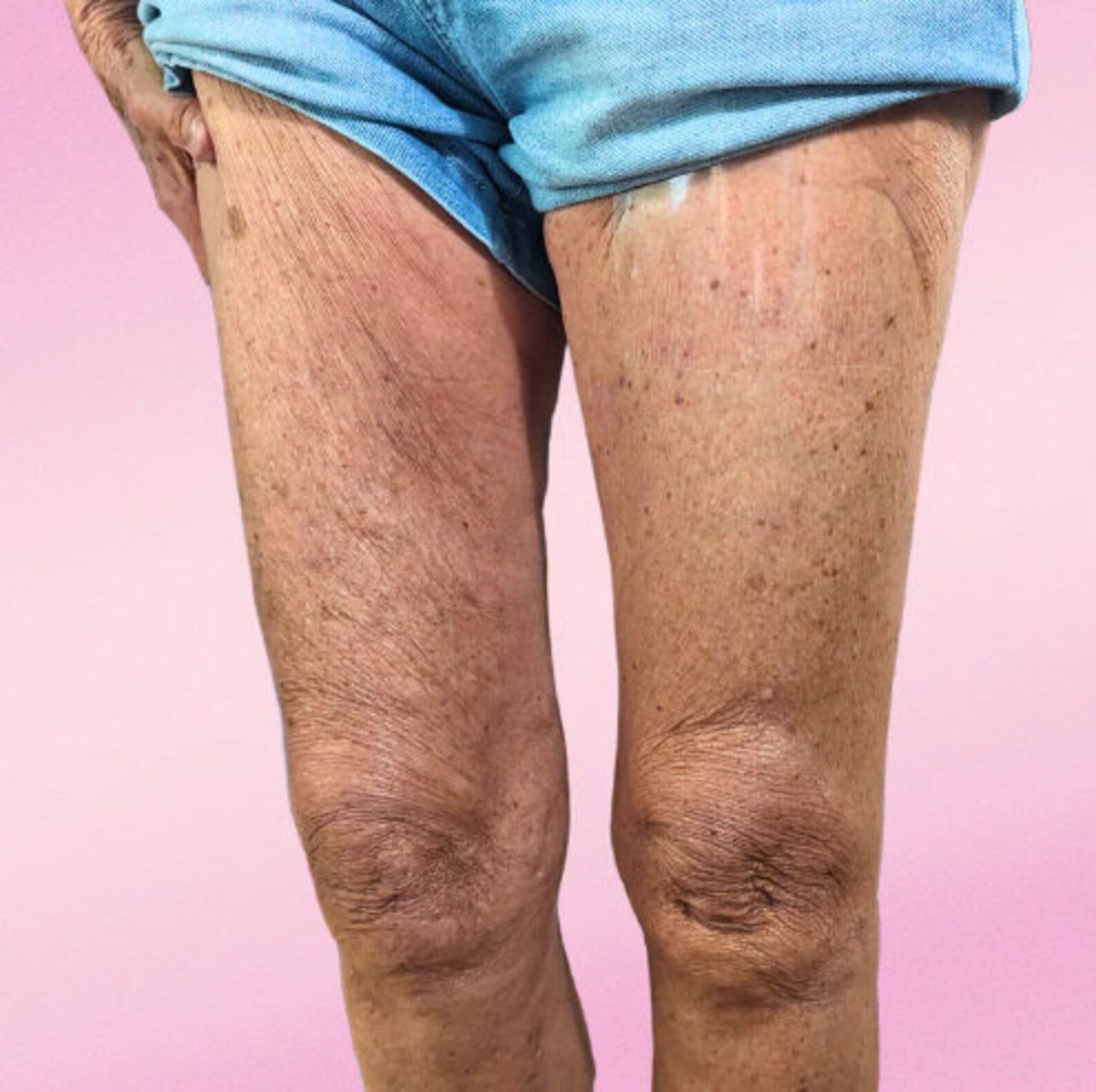 VeloraLift — Body Contouring Lift Patches for Discreet Shaping and Clothing Support