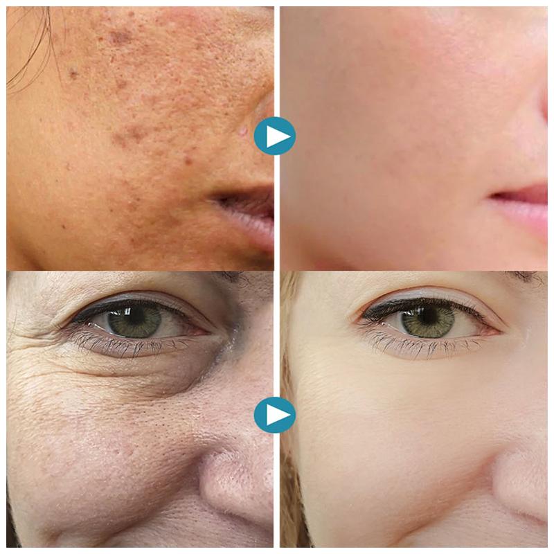 RadianceGlow - Skin Perfecting Cream