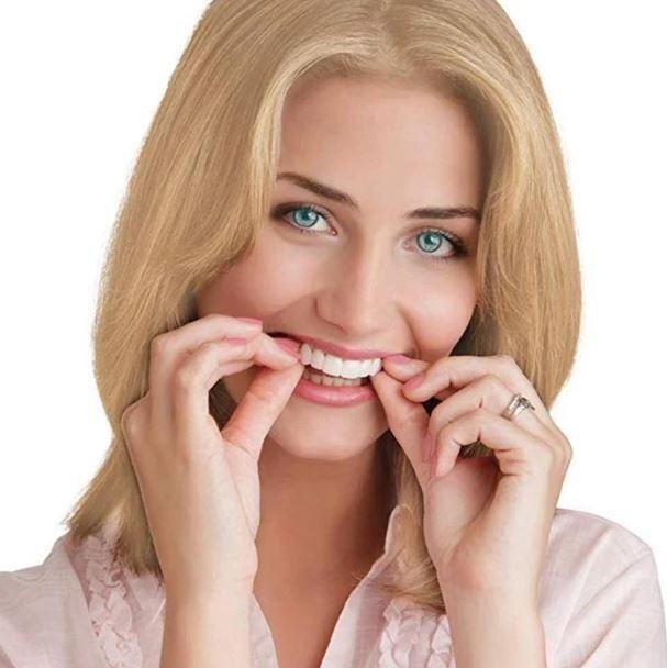 SmileSnap - Clip-On Cosmetic Teeth Cover