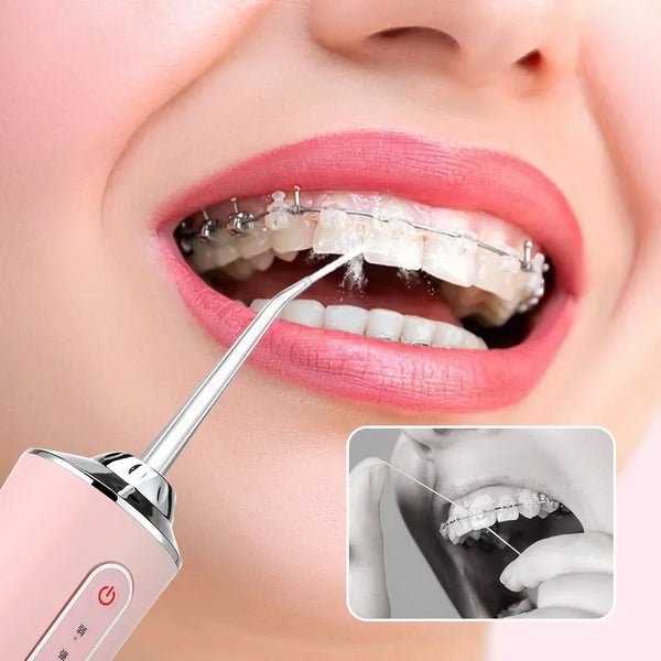 FreshFlow - Portable Cordless Water Flosser