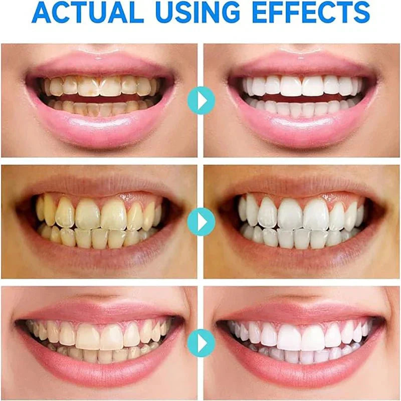 PureTeeth – gel pro každodenní péči